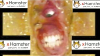 მეორადი ჰიკა მასტუბი ...